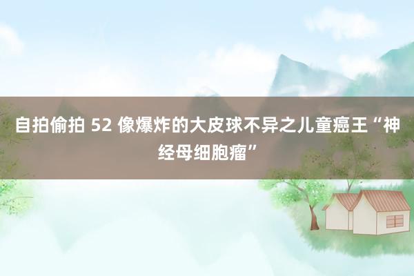 自拍偷拍 52 像爆炸的大皮球不异之儿童癌王“神经母细胞瘤”